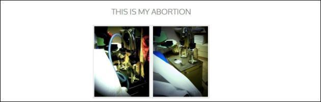 Copertina di “Questo è il mio aborto”, fotografa pubblica scatti dell’intervento su un blog