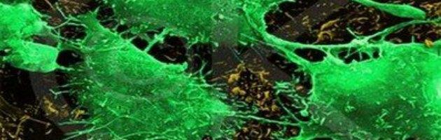 Cancro, virus dell’herpes riprogrammato per uccidere cellule tumorali