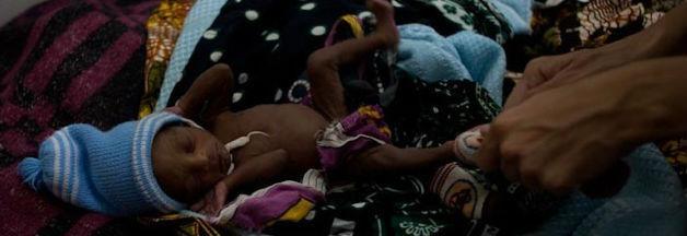 E’ Africa Cuamm: un neonato prematuro e la forza della fotografia