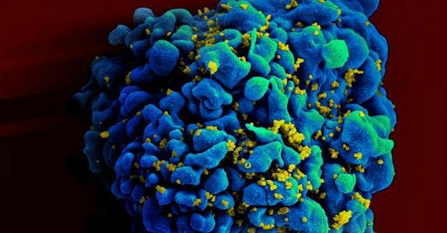 Aids, ritorna sieropositivo il bambino in cui le tracce del virus sembravano scomparse