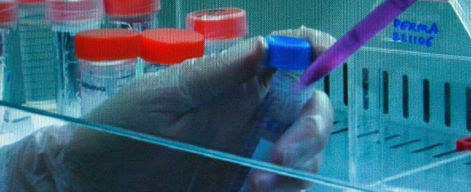 Hiv, scoperta una proteina che può bloccare la diffusione del virus. Lo studio italiano pubblicato su Nature