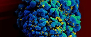Copertina di Aids, studio Usa: “Farmaco anticancro per stanare l’Hiv nascosto nel corpo”