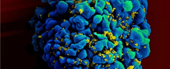 Aids, studio Usa: “Farmaco anticancro per stanare l’Hiv nascosto nel corpo”