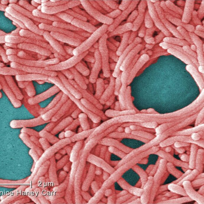 Allarme legionella, 108 casi e 5 morti a New York: “Tracce del batterio nelle torri di raffreddamento”