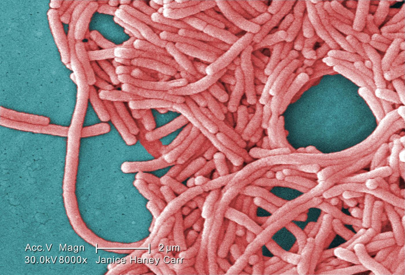 Legionella, allarme alla corte d’Appello di Roma: “Presenza elevata del batterio”