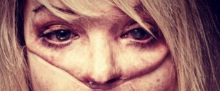 Copertina di Katie Piper, su Instagram le foto dell’ex modella sfigurata dall’acido