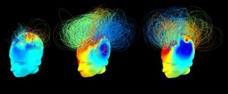 Copertina di Cervello, “potenziale clinico nascosto nelle sostanze psichedeliche”