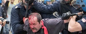 Copertina di Salvini contestato a Massa, manifestante ferito alla testa negli scontri con la polizia