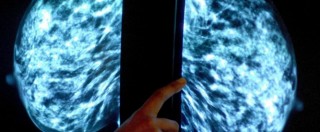 Copertina di Tumori, nel 2015 calano quelli negli uomini. “Ma ancora mille casi al giorno, in donne aumenta cancro polmoni”