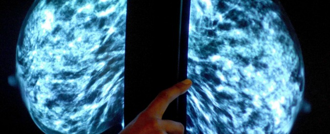 Cancro al seno, “nanofarmaco efficace in pazienti anziane prima della chirurgia”