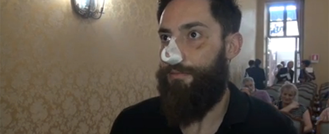 Copertina di Torino, l’attivista gay che la destra ungherese vuole morto: “Qui per operarmi al naso che mi hanno rotto”