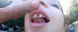 Copertina di Come far cadere un dente da latte? Ai tempi del 2.0 ci pensa il drone