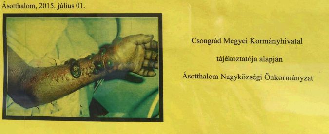 Copertina di Ungheria, manifesto choc al confine con la Serbia: “Rischio contagio da migranti” (FOTO)