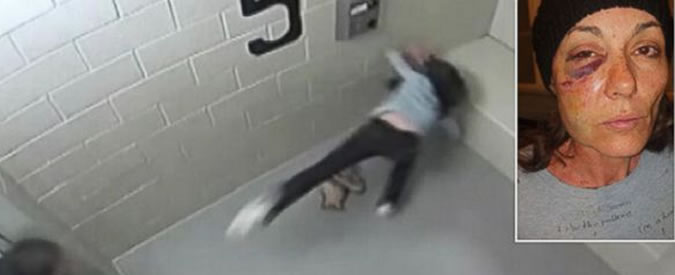 Copertina di Usa, poliziotto le sfigurò volto nel 2013: oggi ottiene maxi risarcimento di 875mila dollari