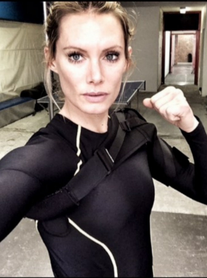 Olivia Jackson, la stuntwoman delle star perderà un braccio dopo un incidente sul set