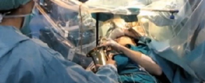 Copertina di Suona il sassofono mentre lo operano al cervello: l’intervento a ritmo di jazz