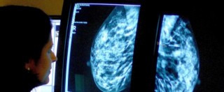 Copertina di Cancro al seno, “poca informazione su rischi ereditari”: nasce prima mappa per sapere dove fare test genetico