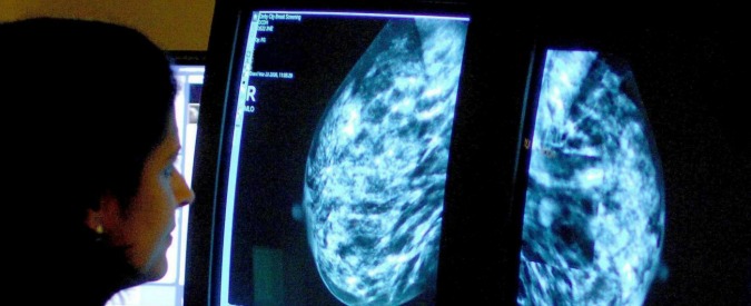 Cancro al seno, “poca informazione su rischi ereditari”: nasce prima mappa per sapere dove fare test genetico