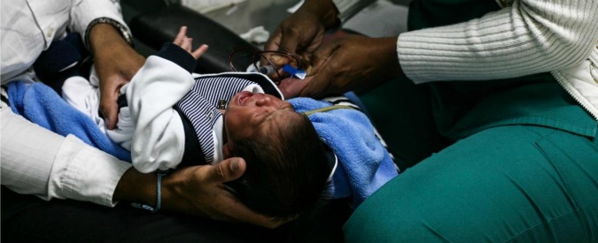 Virus Zika, “individuato virus nel tessuto di due bambini morti per microcefalia”