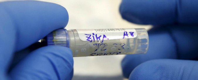 Zika, nasce bimbo affetto da microcefalia per virus in Spagna: primo caso in Europa