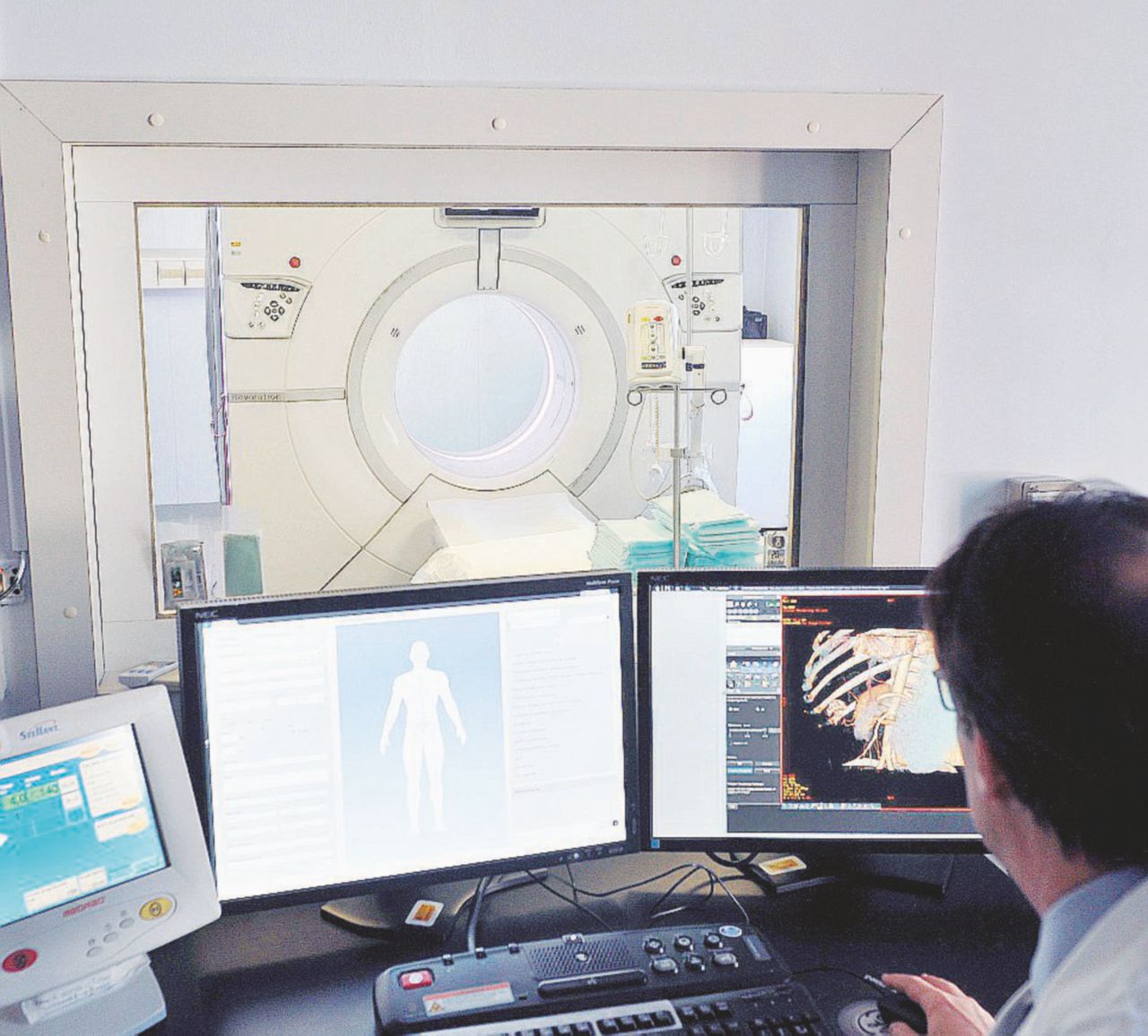 A forza di tagli cala pure l’aspettativa di vita degli italiani