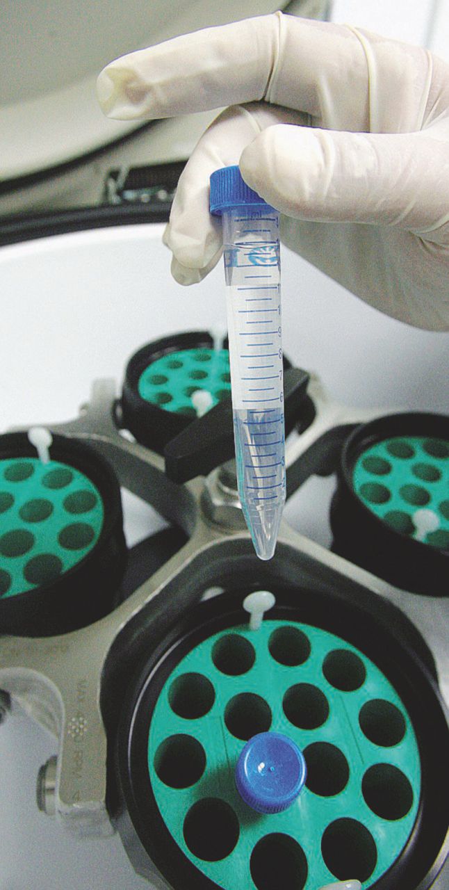 Oligopolio - In Italia i gruppi farmaceutici riescono a imporre allo Stato i loro prezzi sui vaccini - Ansa Quant’è opaco (e costoso) il mega affare dei vaccini