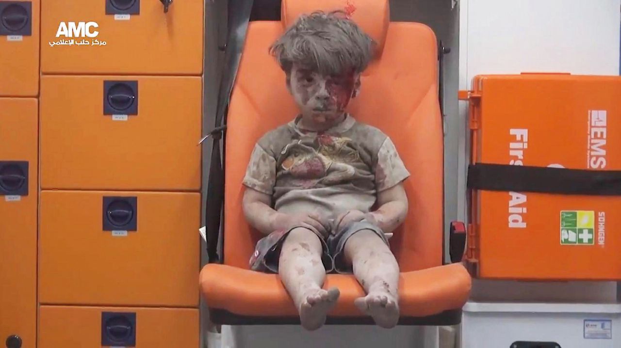 Omran emblema della guerra resta ad Aleppo come simbolo Omran emblema della guerra resta ad Aleppo come simbolo