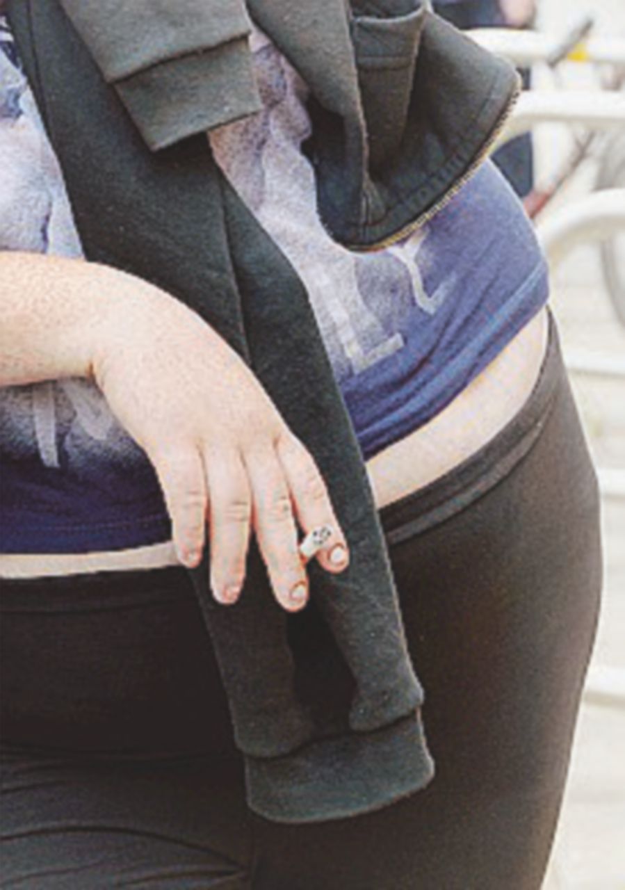 Il dramma di Martina: “Non può lavorare perché troppo grassa”