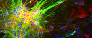 Copertina di Cervello, così parlano i neuroni. Studio italiano “corregge” teoria da Nobel