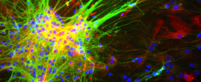 Cervello, così parlano i neuroni. Studio italiano “corregge” teoria da Nobel
