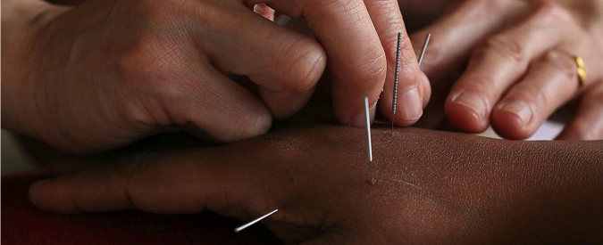 Agopuntura: perché è efficace e inutile – Parte II
