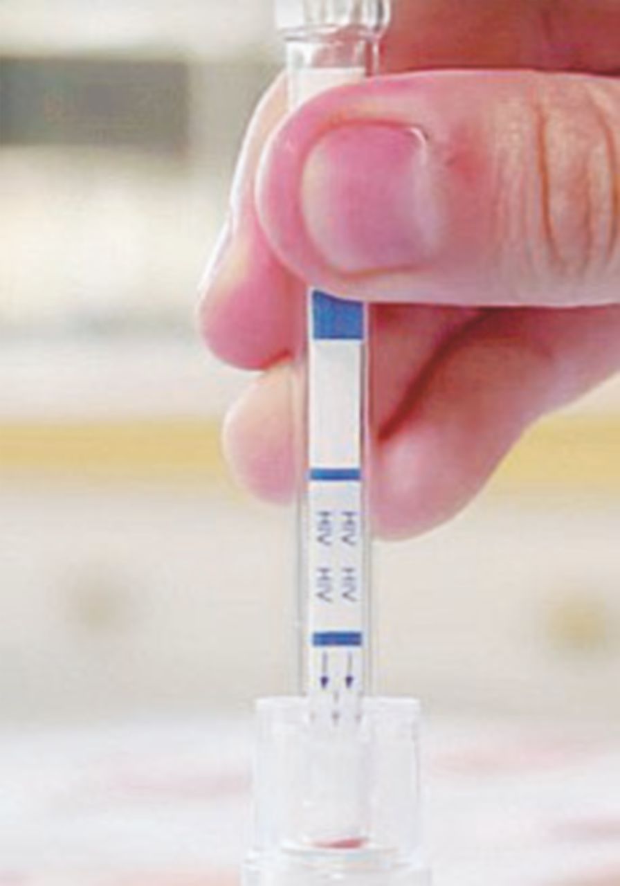 Nelle farmacie il kit fai-da-te per il test dell’Aids Nelle farmacie il kit fai-da-te per il test dell’Aids