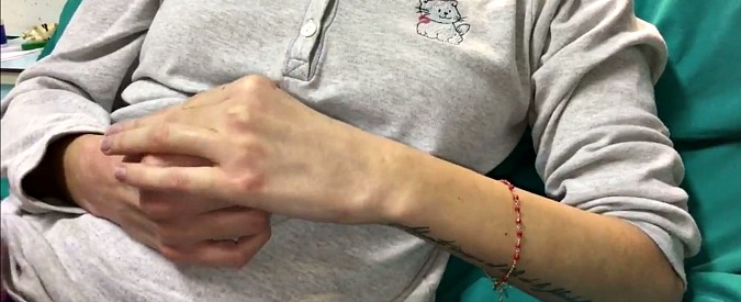 Copertina di Sfregiata con l’acido a Rimini, Gessica Notaro parla dall’ospedale: “La strada è lunga ma sono positiva”