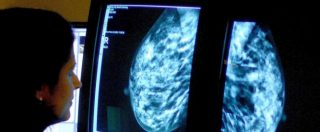 Copertina di Tumore al seno, così si può colpire il motore del cancro grazie al controllo delle sue cellule staminali