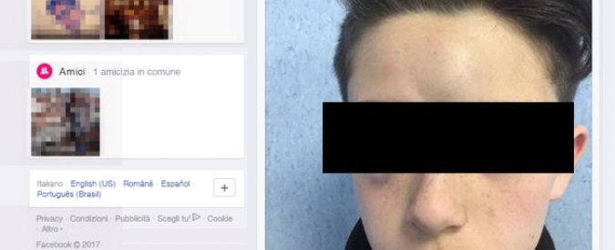 Napoli, genitori pubblicano su Facebook la foto del figlio picchiato da tre bulli: “Non devono passarla liscia”