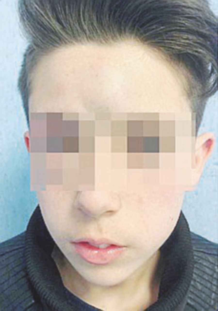 Il padre mette sul web la foto del figlio 13enne pestato dai “bulli” Il padre mette sul web la foto del figlio 13enne pestato dai “bulli”