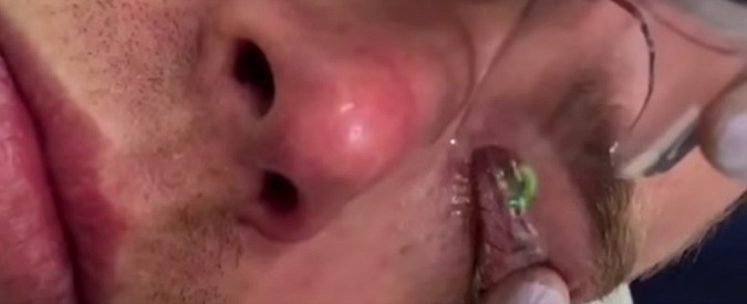 Copertina di Tre notti da leoni, ma al risveglio c’è la sorpresa. E il rimedio è molto doloroso