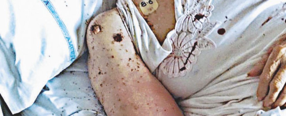 Formiche in ospedale, indaga la Procura Formiche in ospedale, indaga la Procura