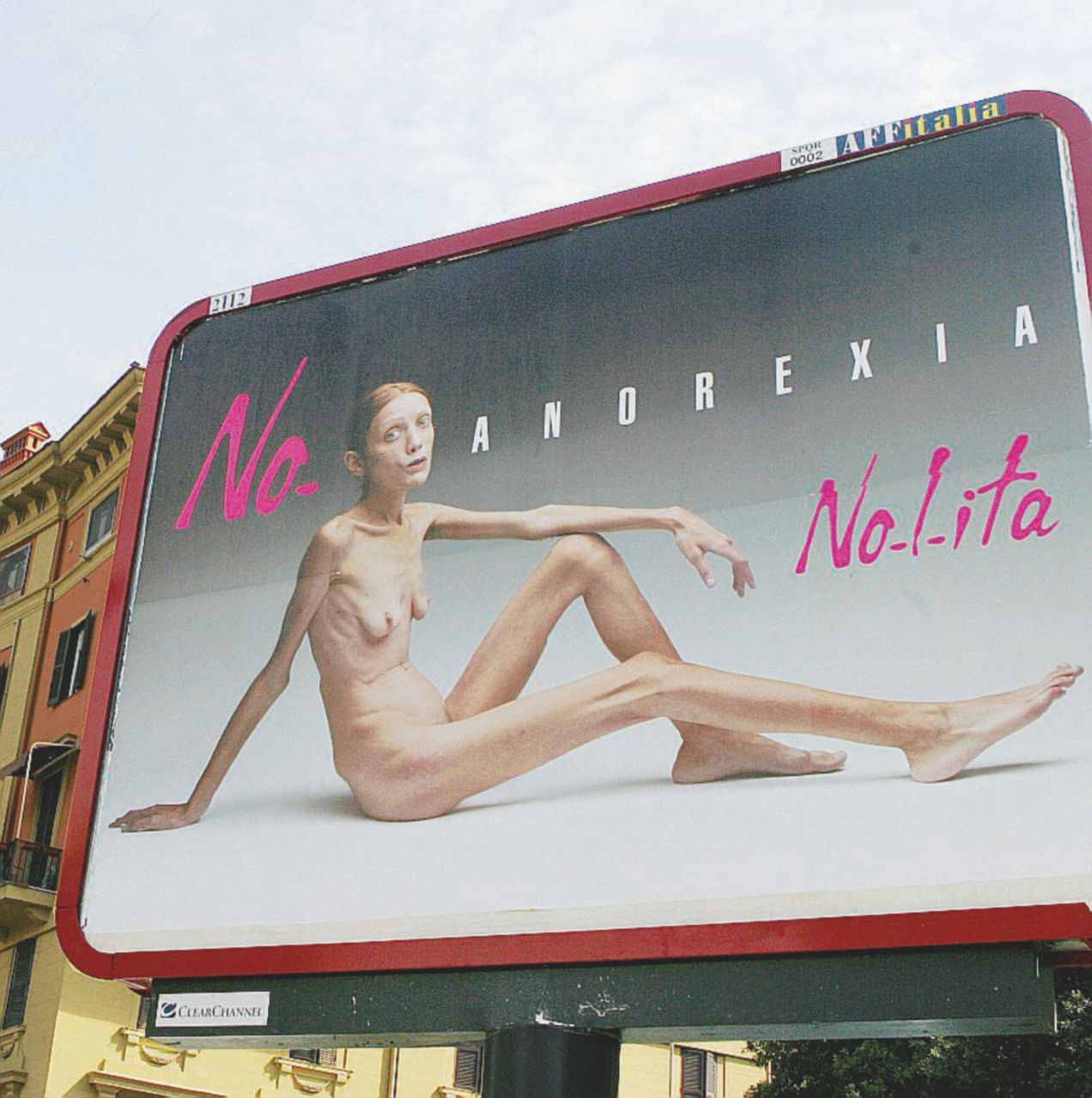 Trattamento disumano - La campagna choc contro l’anoressia del 2007 firmata da Oliviero Toscani - Ansa Sempre più magre, tutto per essere una taglia 36. La denuncia dell’ex modella: “Senza capelli e calcio nelle ossa”