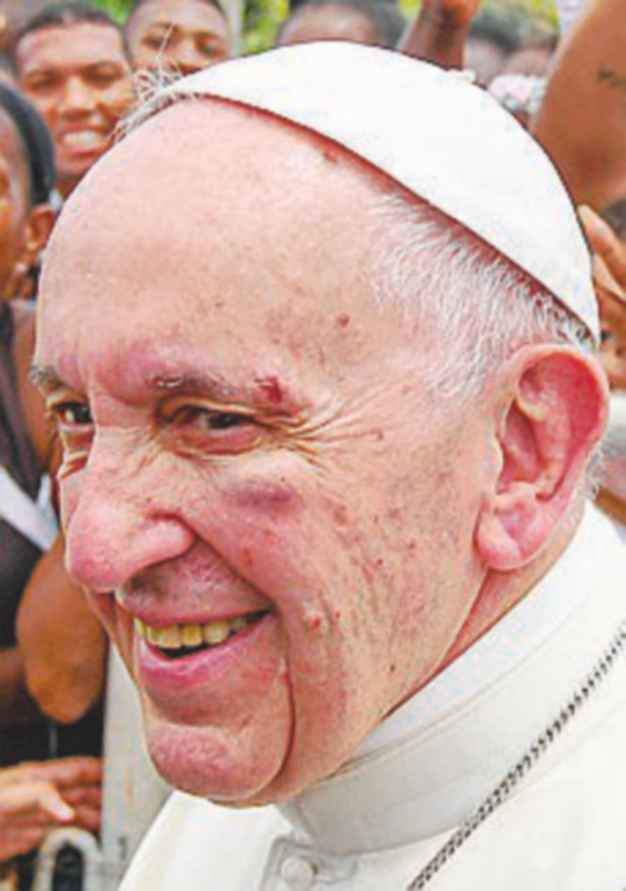 Il Papa sbatte il volto sulla “papamobile” e si ferisce allo zigomo Il Papa sbatte il volto sulla “papamobile” e si ferisce allo zigomo