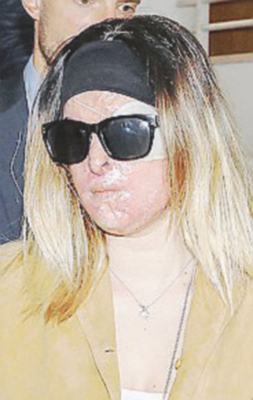 Sfregiò la Miss con l’acido, condannato a 10 anni. Lei: “Non conta, mi ha rovinata”