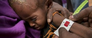 Copertina di Giornata della malnutrizione, nel mondo 155 milioni di bambini soffrono carenza di cibo: 3 milioni i morti ogni anno
