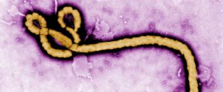 Copertina di Nanoparticelle d’oro nuova arma per aggredire virus diversi: dall’Hiv all’Herpes