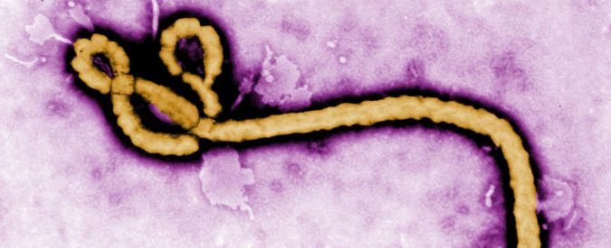 Nanoparticelle d’oro nuova arma per aggredire virus diversi: dall’Hiv all’Herpes