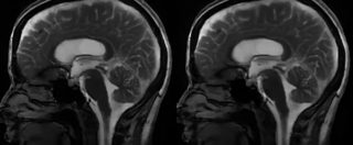 Copertina di La scoperta dello Stevens institute: il cervello batte come il cuore. Ripreso per la prima volta