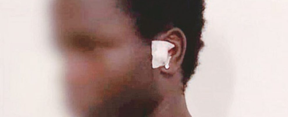 La vittima - Dieng Khalifa, senegale di 24 anni, aggredito con calci e pugni a Partinico (Palermo) - Ansa Aggredito senegalese: “Sono italiano”. Due minuti e mezzo di calci e pugni