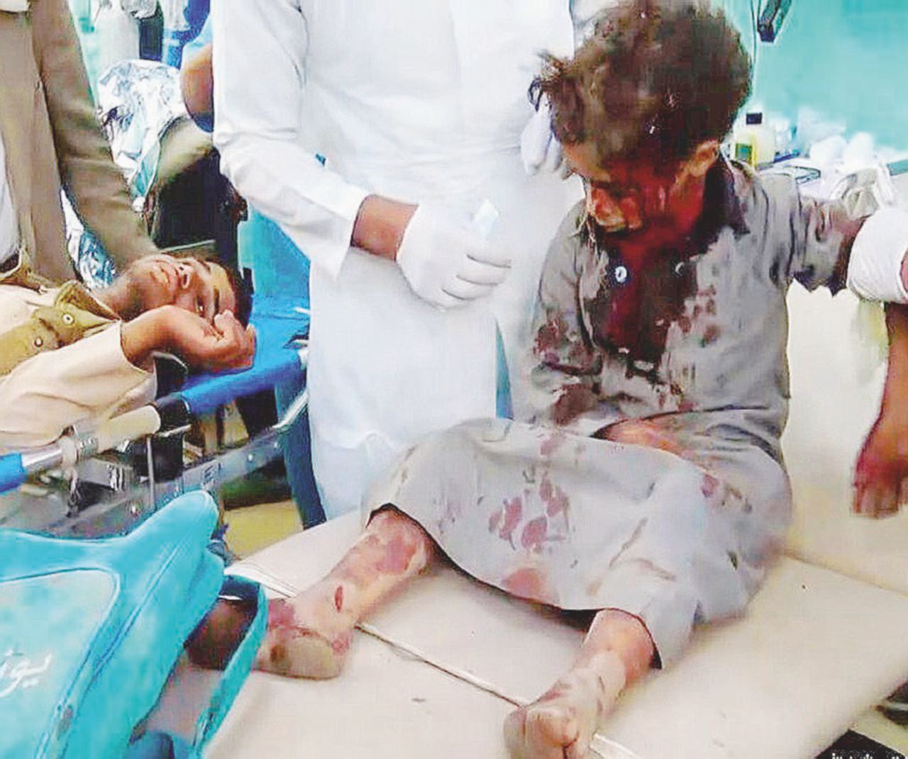 Missile centra uno scuolabus. È strage di bambini a Dahyan Missile centra uno scuolabus. È strage di bambini a Dahyan