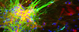 Copertina di Scoperta una nuova misteriosa cellula cerebrale: è il neurone “rosa canina”