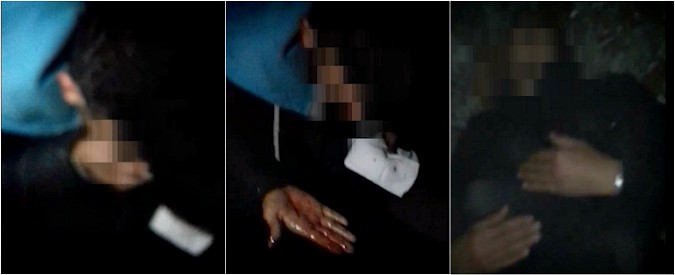 Copertina di Bosnia, siriano soccorre migranti feriti al confine con la Croazia. La denuncia: “Ecco cosa ci fa la polizia”