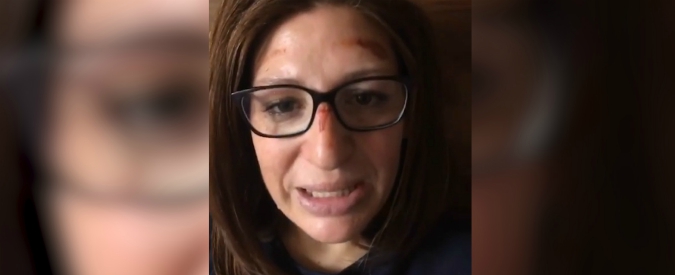 Copertina di Elena Fanchini, torna sugli sci dopo aver sconfitto il cancro ma si infortuna. Il suo messaggio in lacrime: “Una batosta”